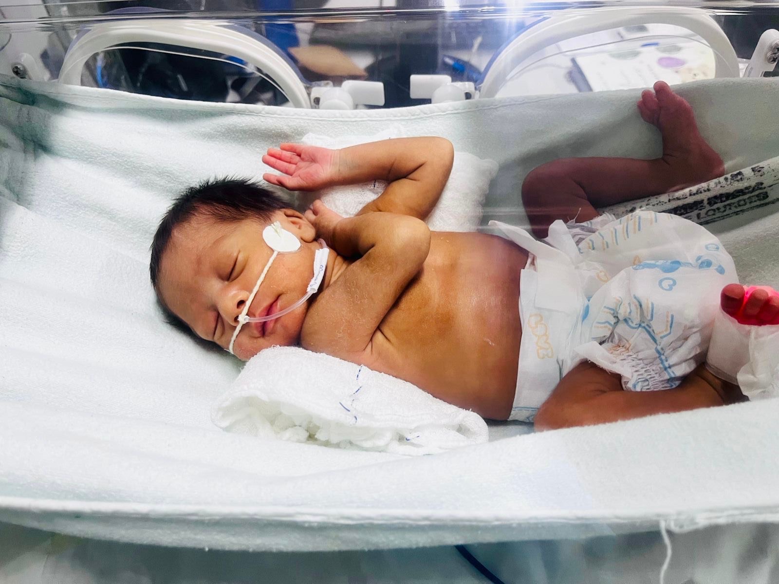 Redeterapia para prematuros no HEMNSL